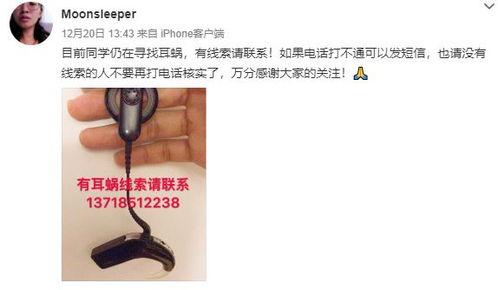 网友爆料耳蜗钉视频大全,网友爆料揭秘耳蜗植入全过程 第2张 网友爆料耳蜗钉视频大全,网友爆料揭秘耳蜗植入全过程 第2张